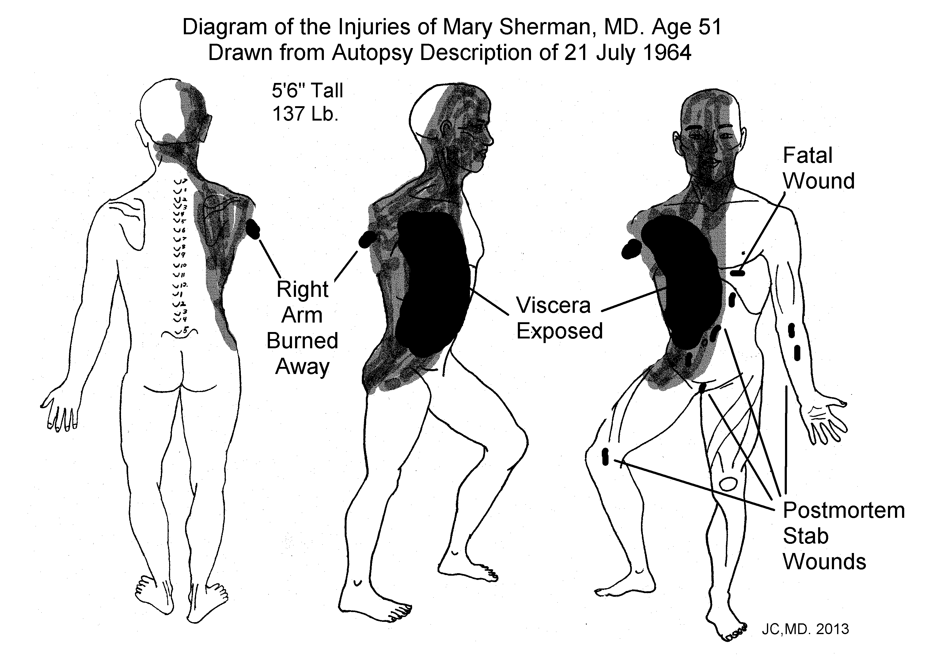 Autopsy Diagram of Mary Sherman, MD., 21 July 1964